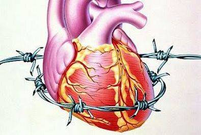 Лечение стенокардии в Израиле